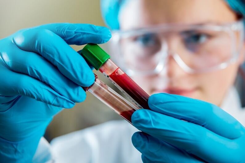 Complete blood test to diagnose lower back pain